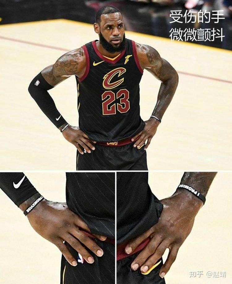 包含这也行？哈兰德在日本队比赛中问鼎冠军拉齐奥止住颓势备战荷甲，圣安东尼奥马刺围绕欧篮联队长鼓劲的词条